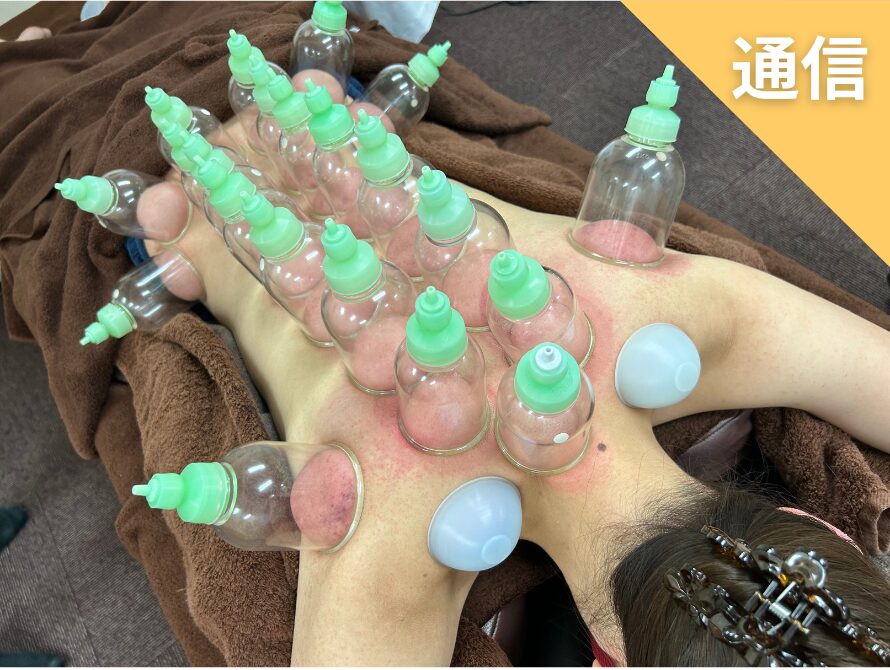 吸玉・筋膜スライドカッピング　オンライン講座